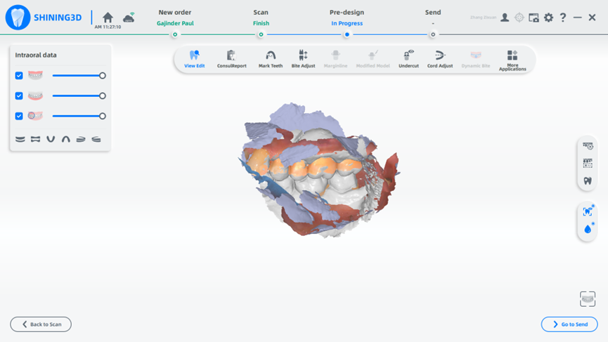 Shining 3D Aoralscan 3 Light