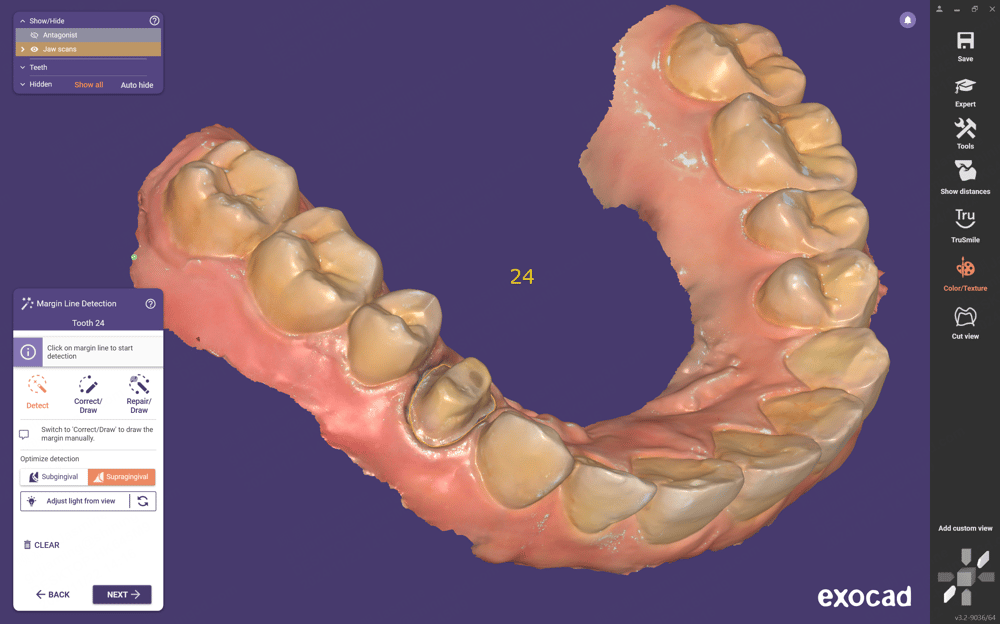 Shining 3D Aoralscan 3 Light