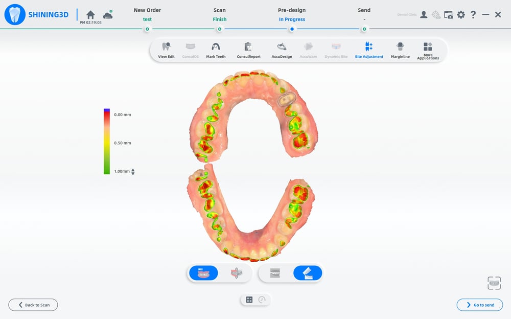 Shining 3D Aoralscan 3